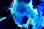 Reconsidering the Role of Male Partners in Recurrent Bacterial Vaginosis