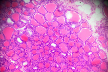 Effects of Hyperosmolar Lubricants on Vaginal Tissue