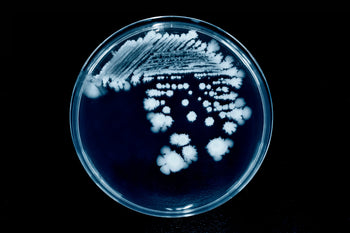Optimizing UTI Treatment: The Critical Role of Providers in Enhancing Patient Outcomes and Reducing Healthcare Costs